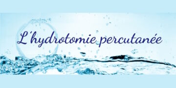 12 Infirmiers condamnés par leur Ordre professionnel pour avoir pratiqué l’Hydrotomie Percutanée