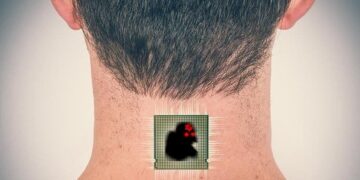 Jérusalem à l&rsquo;avant-garde du puçage « médical »